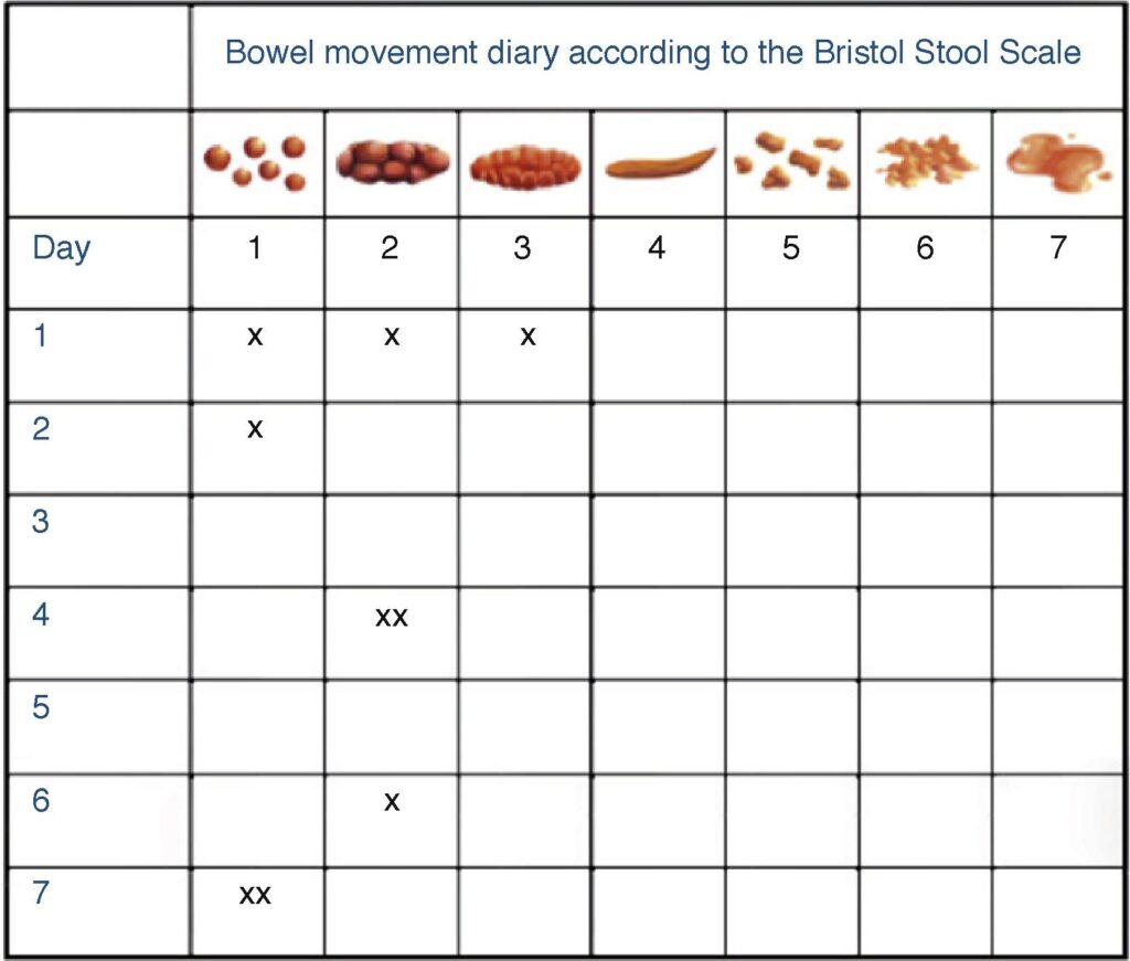 Image Result For Bristol Stool Chart Pdf Bristol Stool Chart Bristol Stool Stool Chart